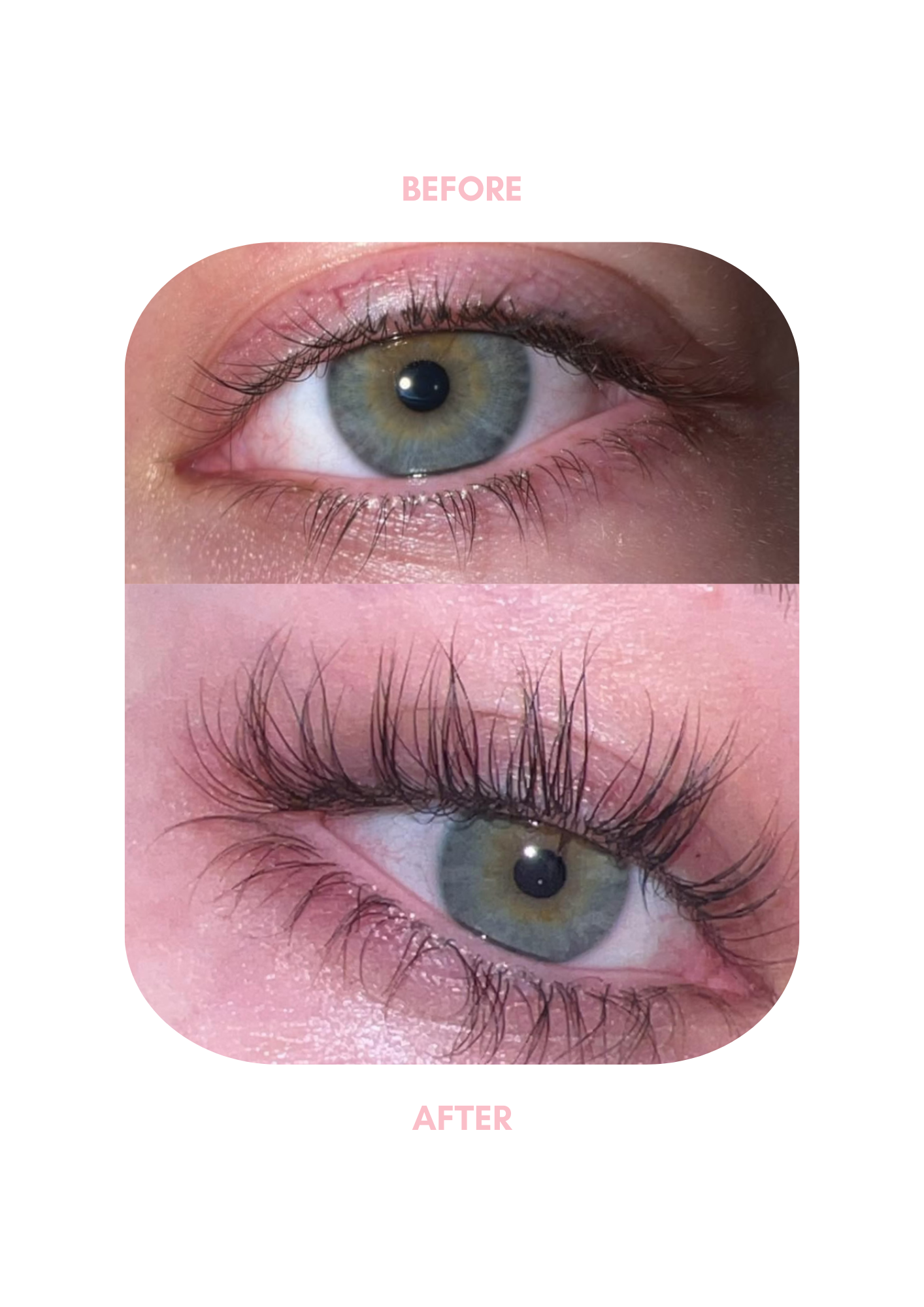 Eyelash Serum